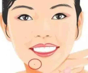5 nốt ruồi tài lộc trên cơ thể sẽ trúng quý nhân, dễ được lãnh đạo đánh giá cao, có thể kiếm được nhiều tiền