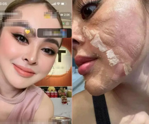 Ám ảnh gương mặt như 'mãng xà lột da' của Trang Nemo