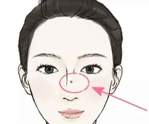 Những nốt ruồi phá tướng mặt phụ nữ, cả đời tiền chẳng có mà tình long đong