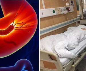Đau bụng đi viện, cô gái 24 tuổi sốc nặng khi biết mình mắc K dạ dày: Triệu chứng dễ nhầm lẫn với rối loạn tiêu hóa nên ít người để tâm