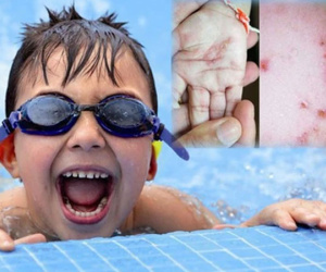 Đi bơi ngày hè nắng nóng: Nguy cơ mắc 8 bệnh nguy hiểm