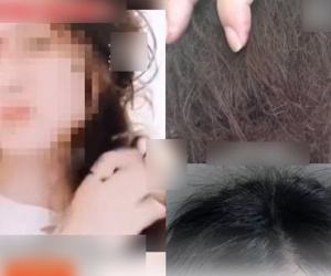 Sợ hãi vì rụng tóc quá nhiều, cô gái học trên mạng 3 tháng không gội đầu, không chải tóc và cái kết 'khóc thành sông'