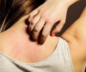 Những dấu hiệu cảnh báo cơ thể bạn đang chứa đầy độc tố, giải độc ngay trước khi quá muộn