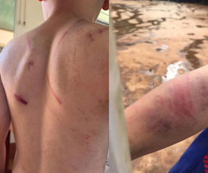 Cháu bé 9 tuổi bị bà và cha đánh đập dã man