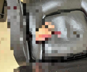 Nam thanh niên bị chém đứt lìa bàn tay ở tiệm cắt tóc