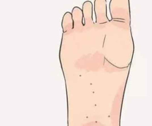 Ý nghĩa 6 nốt ruồi ở những vị trí đặc biệt, sở hữu vị trí này không thành vua thì cũng là quan chức cấp cao