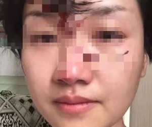 Phó giáo sư đại học bị mất chức vì 'đấm vợ không trượt phát nào' hơn 1.000 lần kể cả lúc mang thai