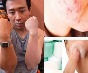 Trấn Thành gặp 'nạn' vì bôi kem trộn