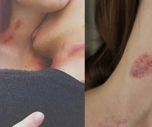 Cô gái 23 tuổi qua đời đột ngột sau khi hôn bạn trai, bác sĩ cảnh báo 1 việc đàn ông dù thích mấy cũng đừng làm với bạn gái