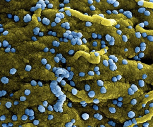 WHO báo động về đợt bùng phát mới của virus chết người