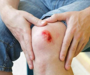5 con giáp nửa cuối năm đề phòng tai nạn, rắn rết cắn, đề phòng xe cộ, đề phòng mất trộm
