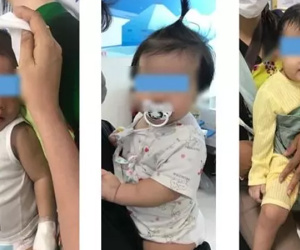 Cảnh báo nhiều trẻ nguy kịch, tử vong vì nhầm sốt xuất huyết với bệnh khác