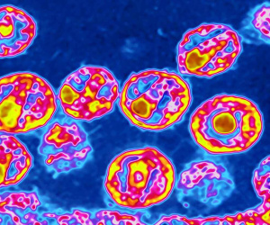 Thêm hai người được tuyên bố khỏi HIV