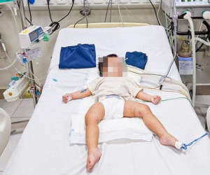 Hình ảnh vết lằn, bầm tím trên người bé 1 tuổi nghi bị bạo hành ở Hà Nội