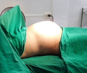 Đi khám vì bụng to bất thường, cô gái trẻ bất ngờ khi biết mình mang khối u buồng trứng 'khủng' nặng 8kg