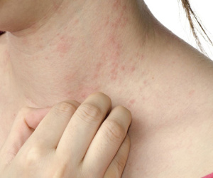 4 thay đổi trên da cảnh báo ung thư sớm, phát hiện dù chỉ 1 dấu hiệu cũng nên đi khám ngay