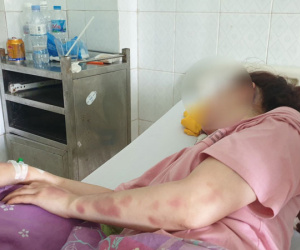 Cán bộ QLTT đánh bạn gái dã man vì hát song ca với người khác: Đã có gia đình, đánh bạn gái do quá yêu