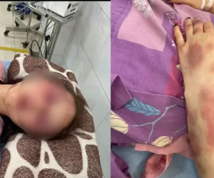 Vụ cán bộ QLTT bị tố đánh đập, lột đồ người tình: Vì sao chưa thể giám định thương tật nạn nhân?
