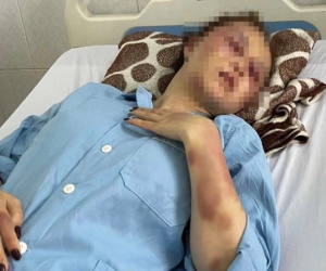 Vụ đánh người tình vì song ca với với người khác: Công an đưa nạn nhân đi giám định thương tật