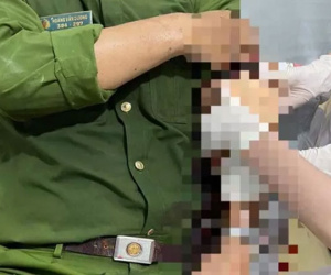 Vụ Trung úy công an bị đâm bằng xiên nướng thịt: Bắt tạm giam kẻ gây án