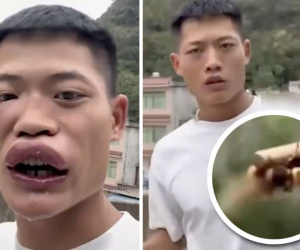 Ăn sống ong bắp cày để gây sự chú ý, nam influencer nhận về kết đắng cùng làn sóng phẫn nộ từ dư luận