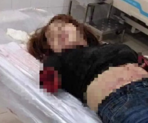 Hãi hùng lời khai của gã chồng chém lìa 2 cánh tay vợ