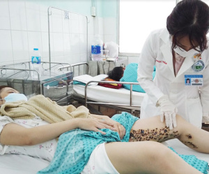 Ảnh minh họa