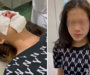Nữ sinh phải vào viện tâm thần điều trị sau khi bị chọc ghẹo, xịt hơi cay bỏng mặt