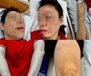 Vụ người phụ nữ ở Hà Nội tố bị chồng cũ hành hung gần 1 ngày: Hung thủ trình diện, khai nhận hành vi