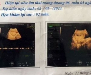 Bảo vệ trường mầm non 70 tuổi nghi xâm hại nữ sinh lớp 6 đến có thai