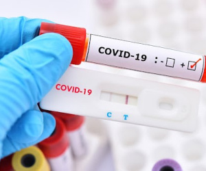 Ngày 21/9, cả nước thêm 2.287 ca mắc Covid-19 mới, 4 trường hợp tử vong