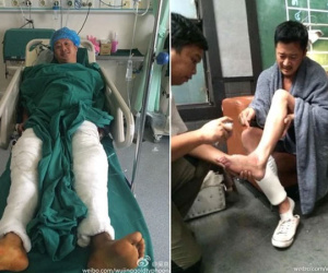 Ngô Kinh bị nát khớp gối, phải chống nạng