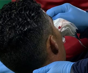 Ronaldo 'tịt ngòi', đổ máu, khiến Bồ Đào Nha bị thổi phạt đền