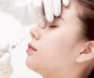 Cô gái 27 tuổi bị mù mắt phải sau khi tiêm filler nâng mũi