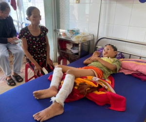 Nghi trộm tiền, cháu bé học lớp 3 bị cha ruột dùng rơm và xăng đốt bỏng 2 chân