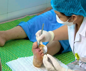 Mắc bệnh hơn 5 triệu người Việt bị, người đàn ông Hà Nội suýt cụt chi vì sai lầm 'nói mãi'