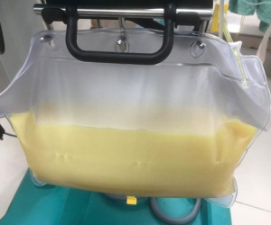 Nghiện thứ đồ uống 'vạn người mê', người đàn ông có huyết tương trắng đục như sữa