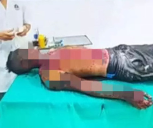 Nổ bình oxy kinh hoàng, thanh niên nguy kịch vì bỏng nặng