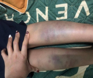 Vụ 'Học sinh ở Đà Nẵng hoảng loạn khi từ trường về nhà': Phụ huynh không đồng ý với kết luận