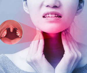 Viêm amidan dễ tái phát lúc giao mùa, thay đổi thời tiết, bỏ túi ngay 4 thói quen giúp phòng bệnh hiệu quả