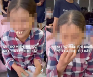 Người phụ nữ có hàm răng lạ, kết quả sau chỉnh sửa ai cũng choáng