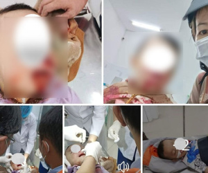 Làm rõ thông tin người mẹ tố CSGT đánh trúng con nhỏ 'gãy sống mũi, nứt xương mặt'