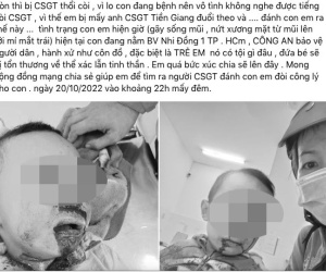 Công an Tiền Giang lên tiếng thông tin tố 'CSGT đánh bé trai'