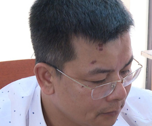 Người đàn ông dí điếu thuốc đang cháy vào mặt công an bị khởi tố
