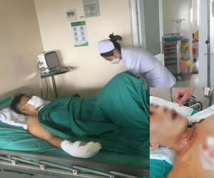 Hãi hùng nam thanh niên bị dây diều cứa cổ khi đang chạy xe máy trên đường