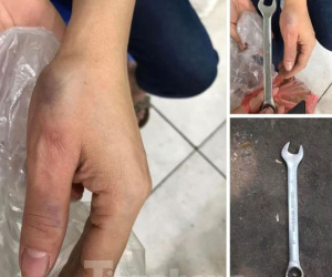 Cờ lê sắt từ tầng cao chung cư Hà Nội rơi trúng người phụ nữ đang bế con
