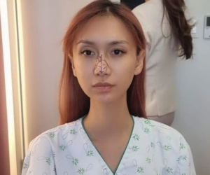 Không ưng ý ngoại hình sau nhiều lần phẫu thuật, Lynk Lee quyết tâm 'dao kéo' đến cùng