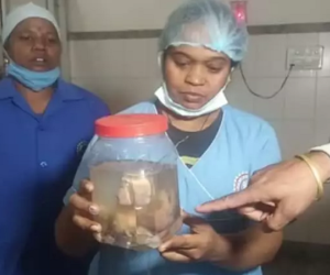 Kinh hoàng bé gái 21 ngày tuổi có 8 bào thai trong bụng