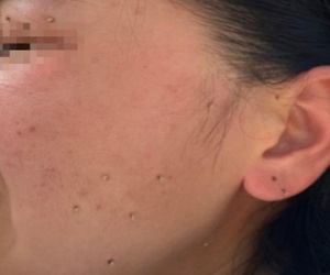 Đàn ong mật khổng lồ hàng ngàn con bất ngờ tấn công nhóm người chơi thể thao