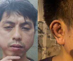 Khởi tố vụ chủ quán lẩu ở Hà Nội đánh biến dạng khuôn mặt nhân viên
